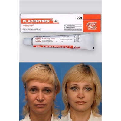 PLACENTREX GEL Albert David (Плацентрекс, плацентарный гель, Альберт Давид), 20 г.