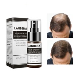 Lanbena Hair Growth Essence Spray - Спрей против выпадения волос.(4241)