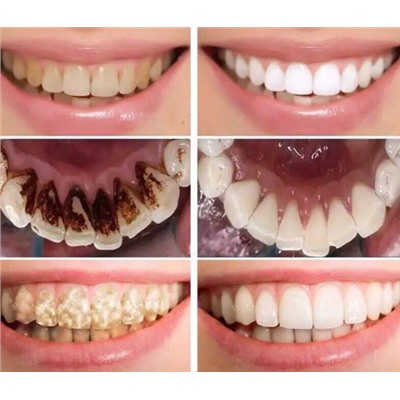Средство для отбеливания зубов AIVOYE 20180827564