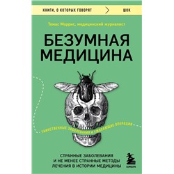 Безумная медицина. Странные заболевания и не менее странные методы лечения в истории медицины