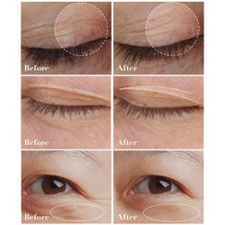 Крем для век антивозрастной с ретинолом Luofmiss Retinol, 30 гр.
