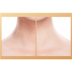 Коллагеновый патч для шеи JomTam Hexapeptide Collagen Neck Mask, 1 штука 30 гр.
