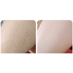 Крем увлажняющий с мочевиной и витамином Е Bioaqua Vitamin E Urea Cream, 170 гр.
