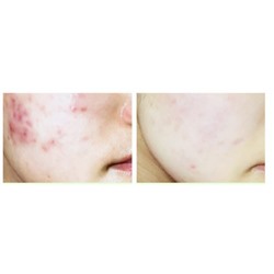 SALE! Bioaqua,Увлажняющий, многофункциональный гель Алоэ Вера с натуральным соком алоэ 90 %  и аллантоином, 170 гр.