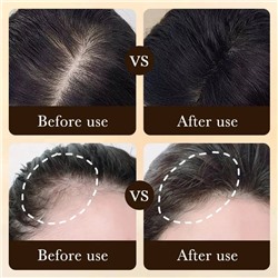 ZOZU Сыворотка-роллер для восстановления и роста волос Anti-Hair Loss Essence 20 мл.