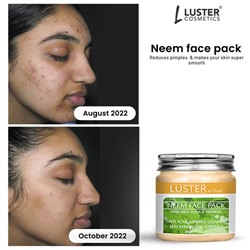 NEEM Face Pack, Luster (НИМ маска для лица, Ластер), 200 г.