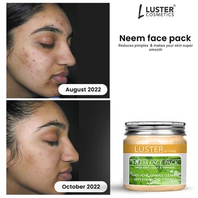 NEEM Face Pack, Luster (НИМ маска для лица, Ластер), 200 г.