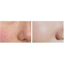 SALE! Bioaqua,Увлажняющий, многофункциональный гель Алоэ Вера с натуральным соком алоэ 90 %  и аллантоином, 170 гр.