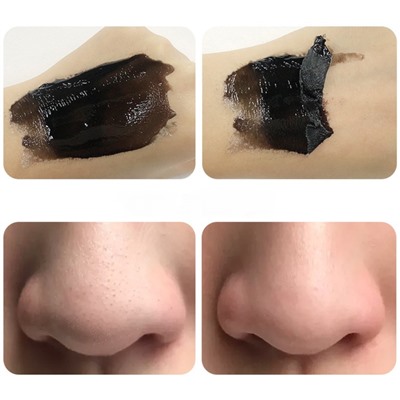 Маска-пленка с салициловой кислотой для глубокого очищения пор Zoo-Son Salicylic Acid Blackhead, 40 гр.