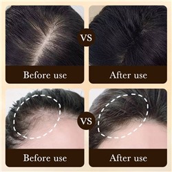 Эссенция укрепляющая против выпадения волос с массажными роликами ZOZU Anti-Hair Loss Essence, 20 мл.