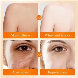 SADOER Отбеливающее мыло для лица и тела с койевой кислотой KOJIC ACID, 100г