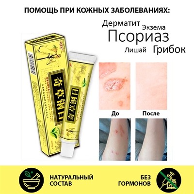 Qicaogangmu (Цикаогангму). Мазь от псориаза | 15 г