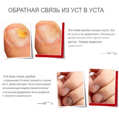 VIBRANT GLAMOUR Крем для восстановления ногтей и лечения онихомикоза VG-ST005 30 мл